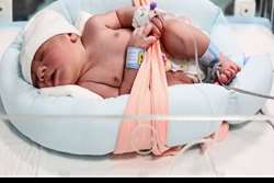 تاثیر مصرف موضعی شیر مادر در زمان افتادن بند ناف نوزاد